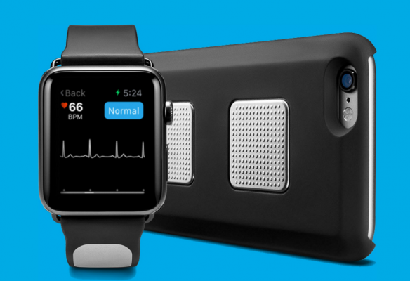 New Kardia Band for Apple Watch Delivers Medical grade ECG Anywhere DAIC